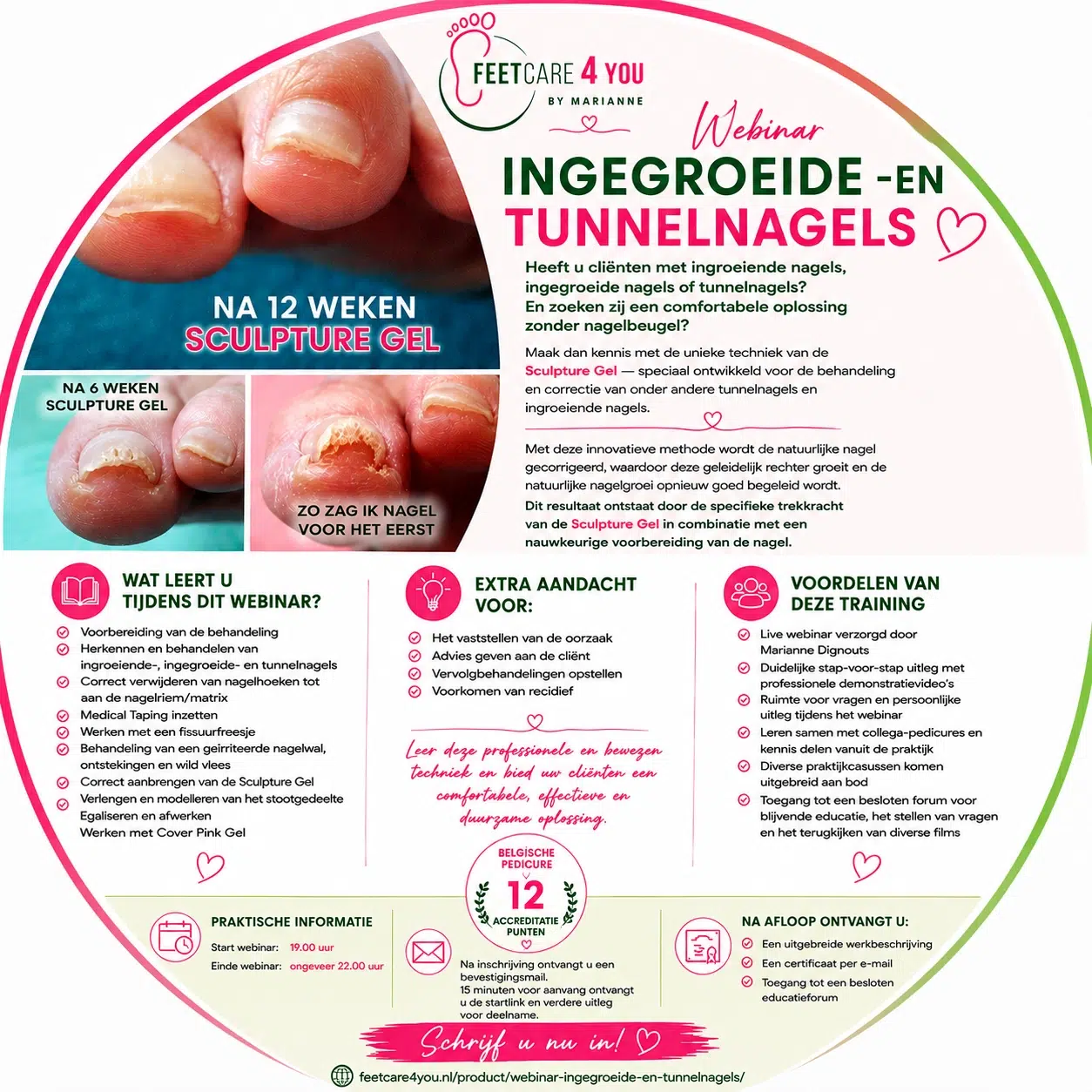Webinar Ingegroeide- en tunnelnagels - Afbeelding 2